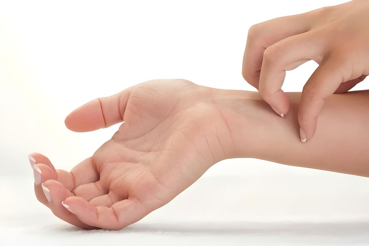 Itchy skin, cause of itchy skin and treatment of itchy skin