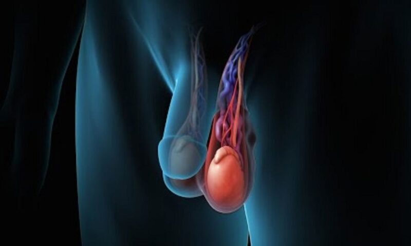 The cause of testicular prolapse in adults and young people