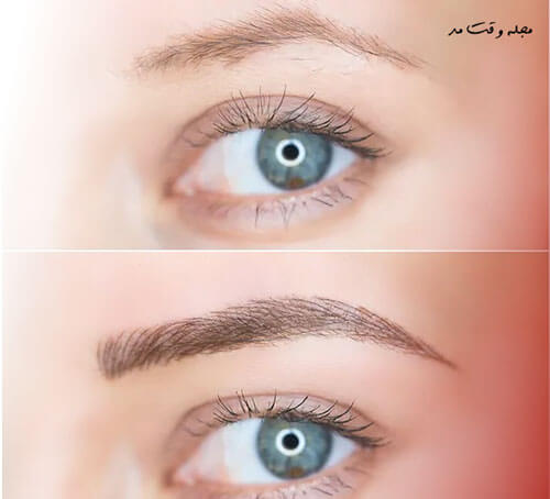 The latest eyebrow fibrosis model for women