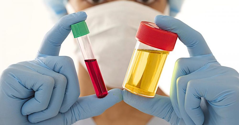 Causes of blood in men's urine