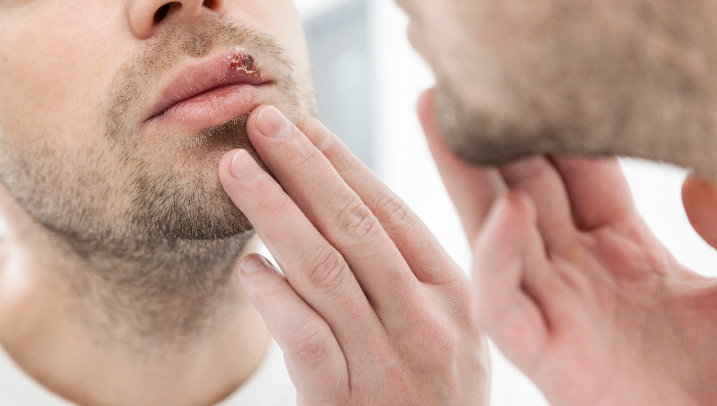 Does a man's saliva cause a vaginal infection?