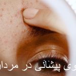 What is a pimple on the forehead?