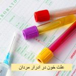 Causes of blood in men's urine