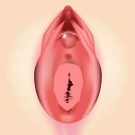 Hymen rupture repair