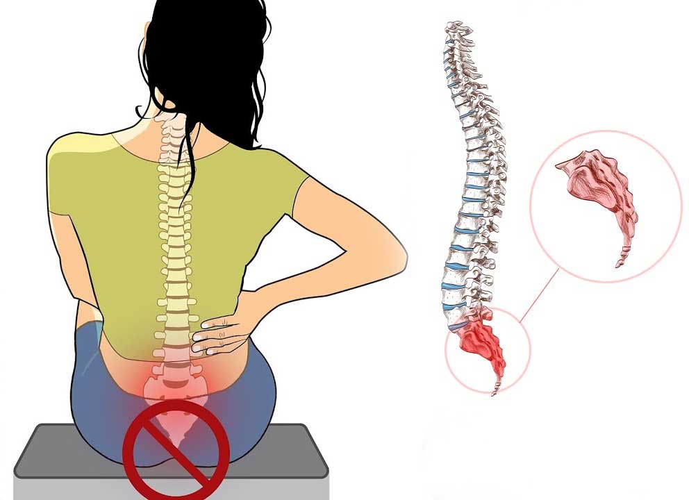 The cause of coccyx pain in women