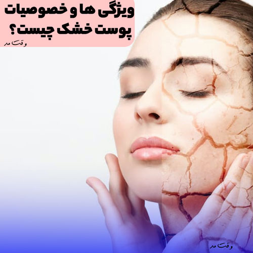 What is dry skin?