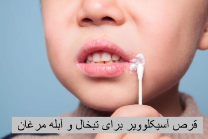 Acyclovir 400 tablets for herpes and chicken pox