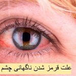 The cause of sudden red eyes