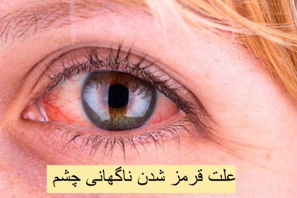 The cause of sudden red eyes