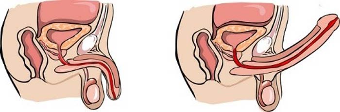 What is the reason for not erecting the male reproductive system?