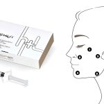 Profile injection points