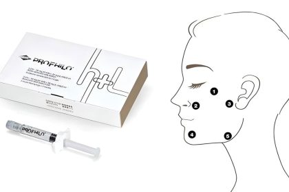 Profile injection points