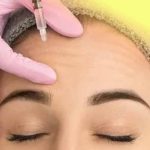 Forehead Botox is used to eliminate forehead wrinkles and wrinkles.
