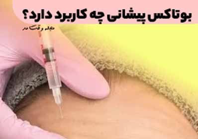 Forehead Botox is used to eliminate forehead wrinkles and wrinkles.