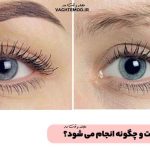 What is eyebrow transplant?