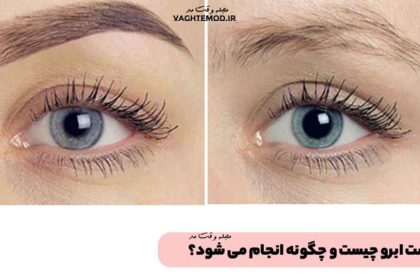 What is eyebrow transplant?