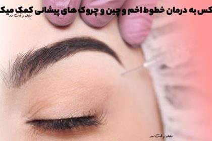 Botox helps treat frown lines and forehead wrinkles