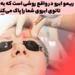 Remo Eyebrow is actually a way to clear your eyebrow tattoo