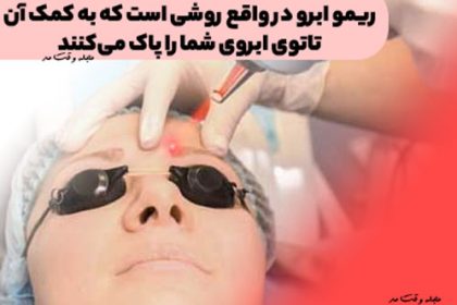 Remo Eyebrow is actually a way to clear your eyebrow tattoo