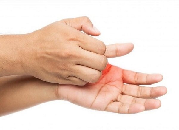 The cause of the itching of the right palm