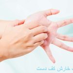 The cause of the itching of the palm