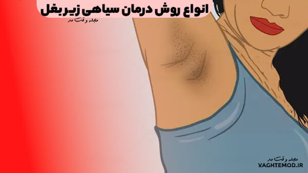 Learn a variety of armpit black treatment in the Fashion Magazine.