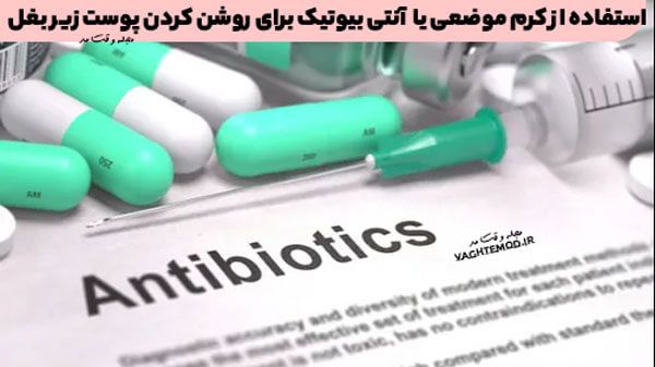 Use topical cream or antibiotics to brighten the armpit skin