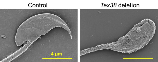 This protein compound is vital for male fertility