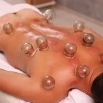 What do we don't get after the cupping