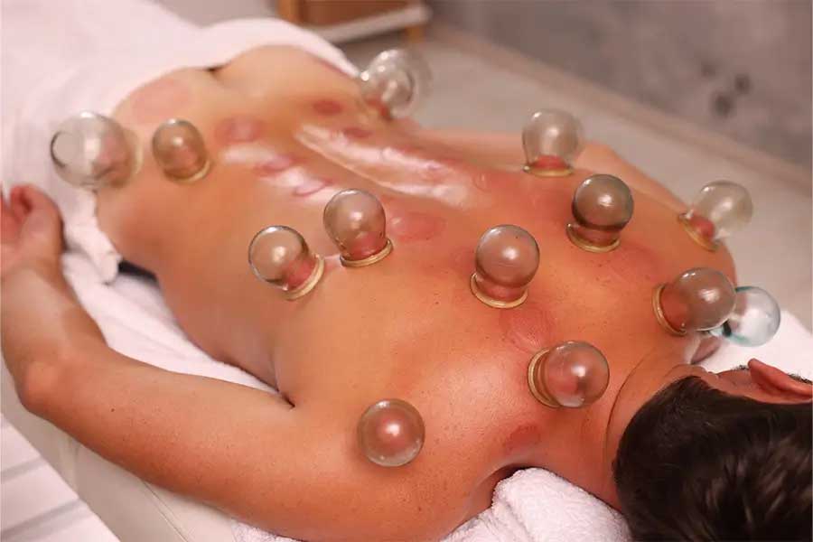 What do we don't get after the cupping