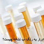 What is a sign of water color?