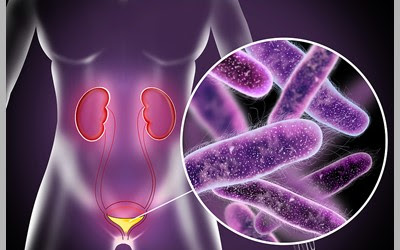 The strongest antibiotics for female urinary tract infection