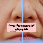 Train a variety of wrinkles in fashion magazine