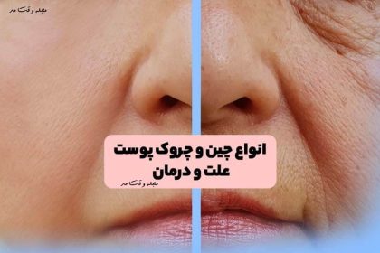 Train a variety of wrinkles in fashion magazine