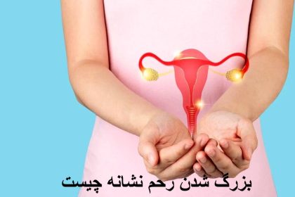What is the signing of the uterus. What is the sign