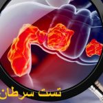 Testing of colon cancer at home