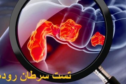 Testing of colon cancer at home