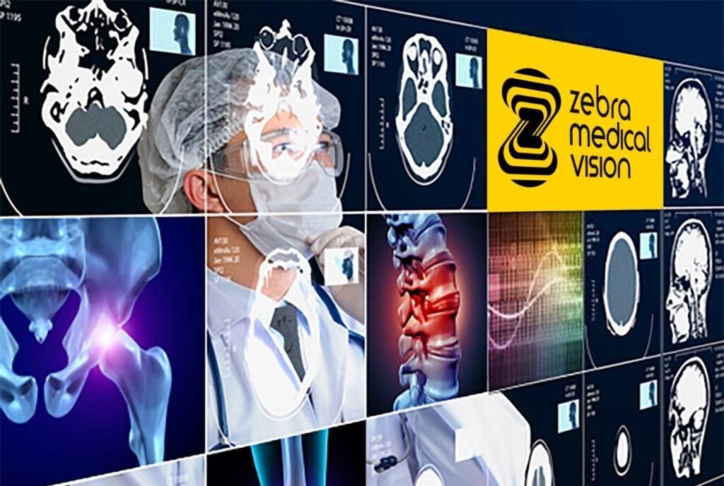 Zebra Medical Vision Best Medical Intelligence 