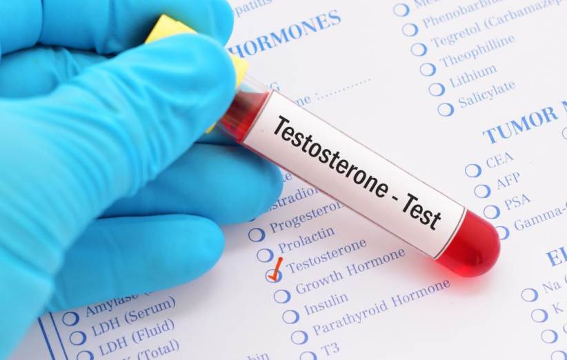 Symptoms of testosterone deficiency in men