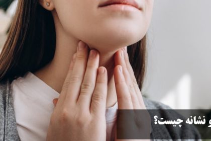 What is a sign of throat?
