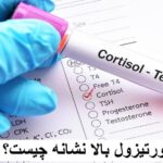 What is the above cortisol?