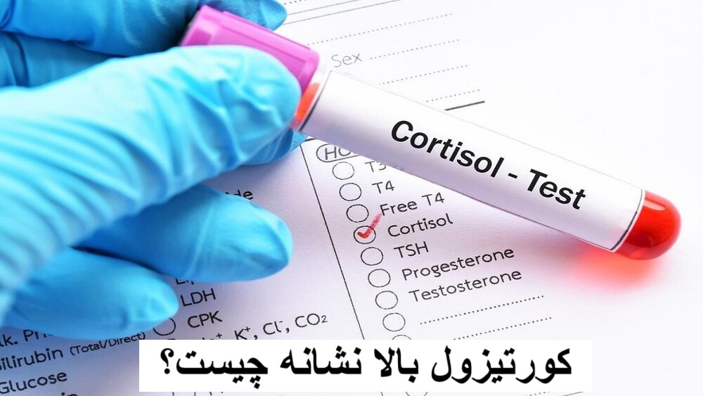 What is the above cortisol?