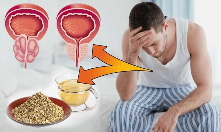 An image of the prostate and its location in the men's body.