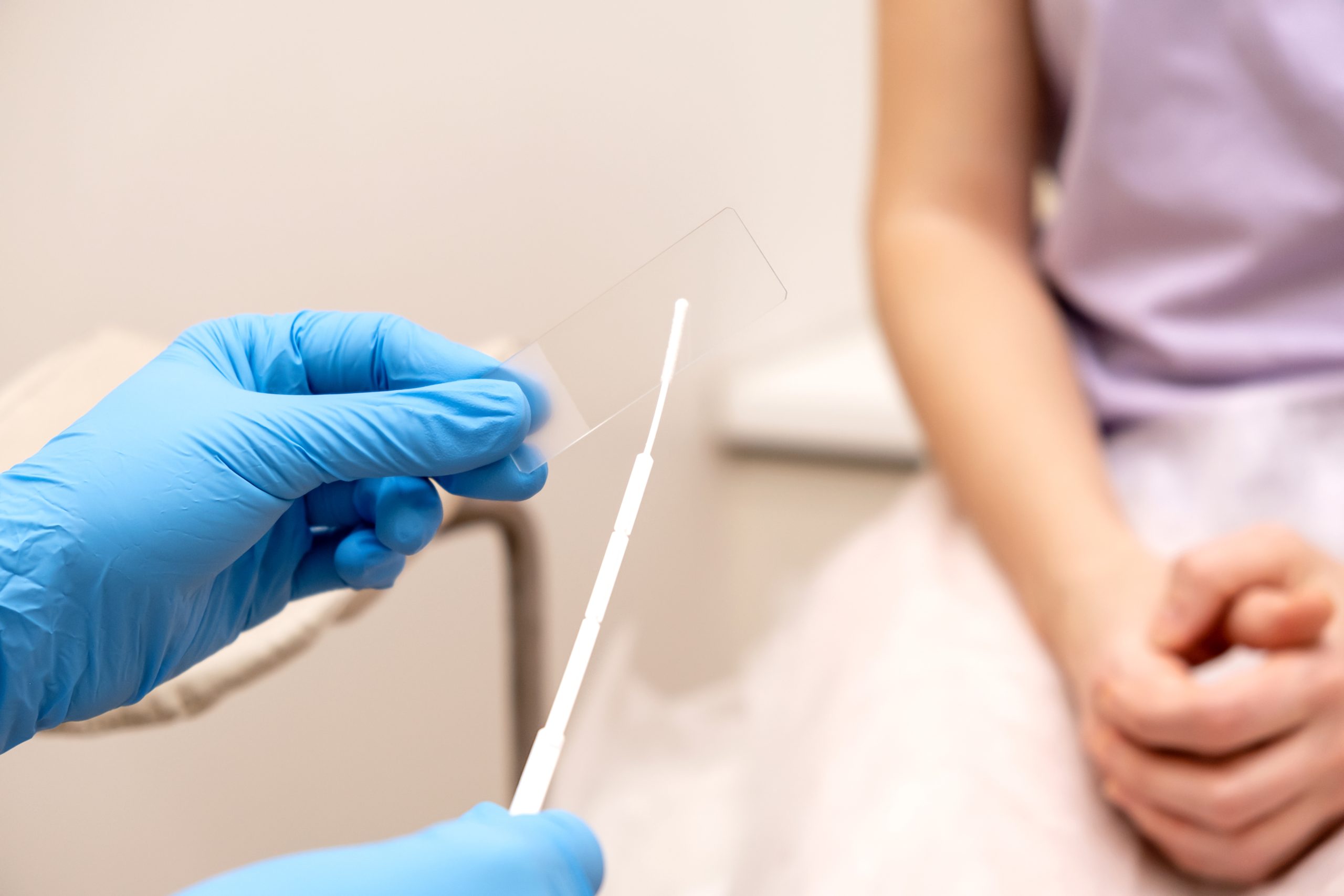 Pap smear test time a few days after the period