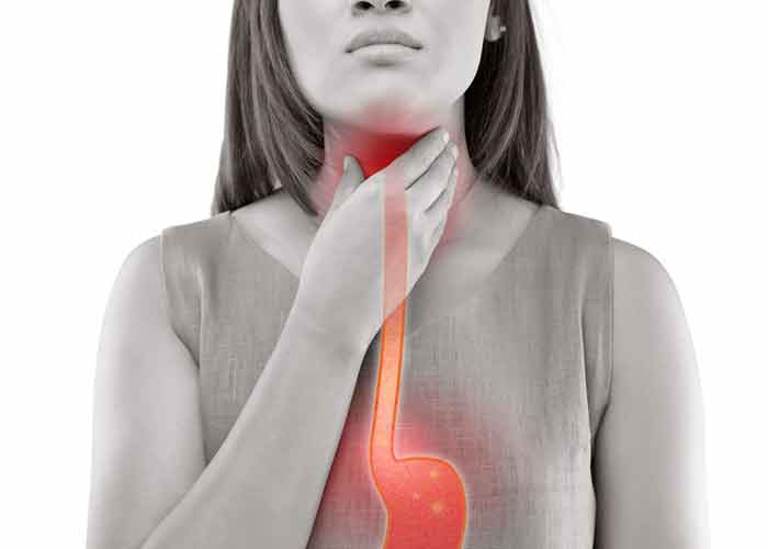 What is the best syrup for gastric reflux and adult stomach irritation?