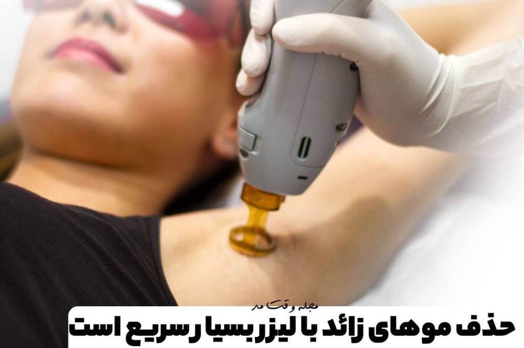 Removal of excess hair with a very fast laser