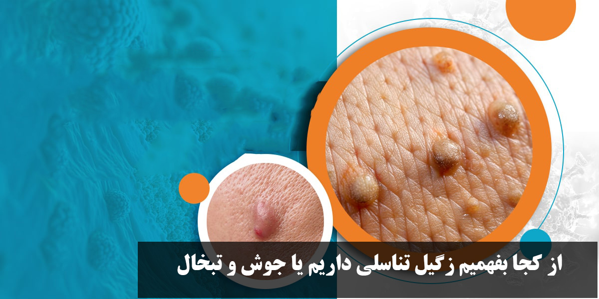 How do we know that we have genital warts or pimples and herpes