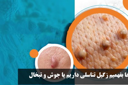 How do we know that we have genital warts or pimples and herpes