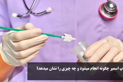 How is Pap smear test done