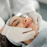 Treatment of facial stains with chemical peeling